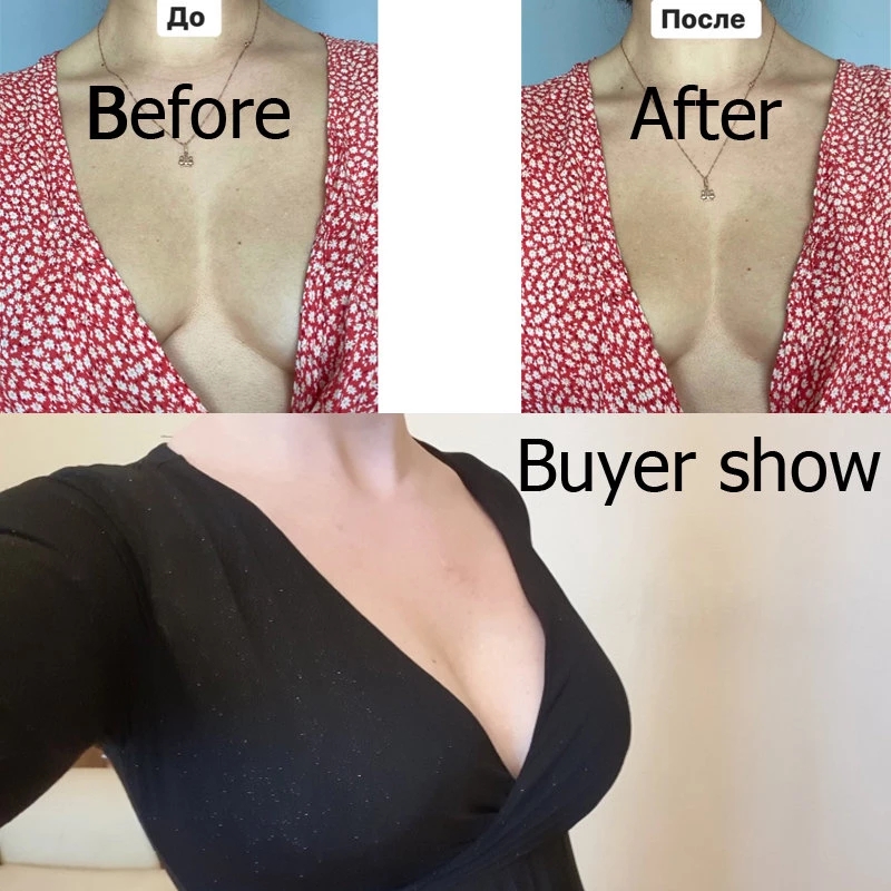 Penutup Puting Pengangkat Kelo - Strapless Bra Backless ulasan dan harga